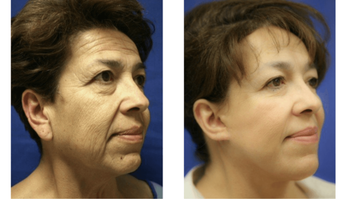face before and after